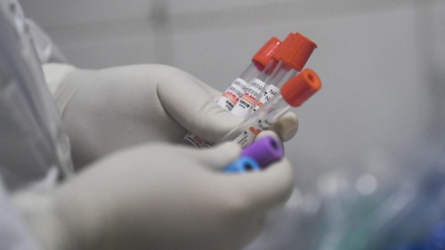 В Великом Новгороде будет выборочная бесплатная проверка на наличие антител к коронавирусу